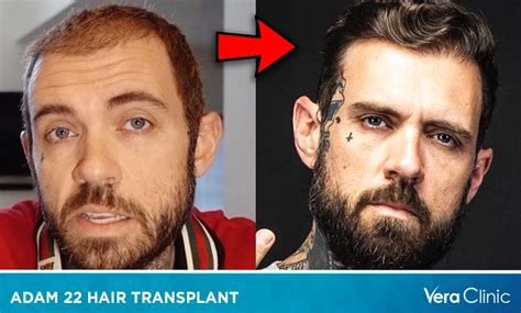 adam 22 trisha|Adam22 .